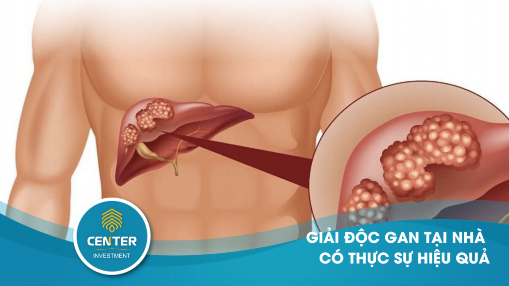 giải độc gan tại nhà