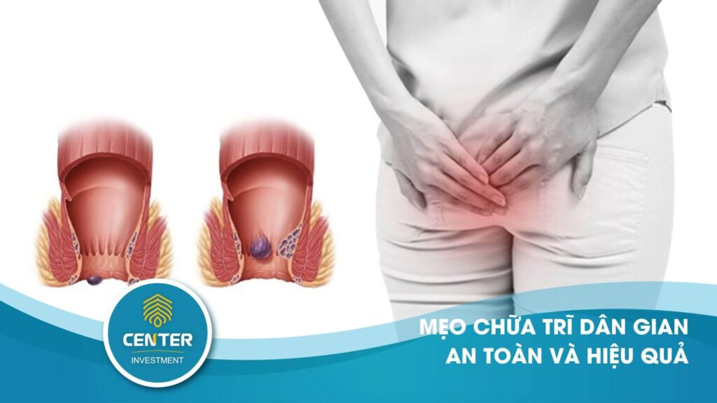 mẹo chữa trĩ dân gian