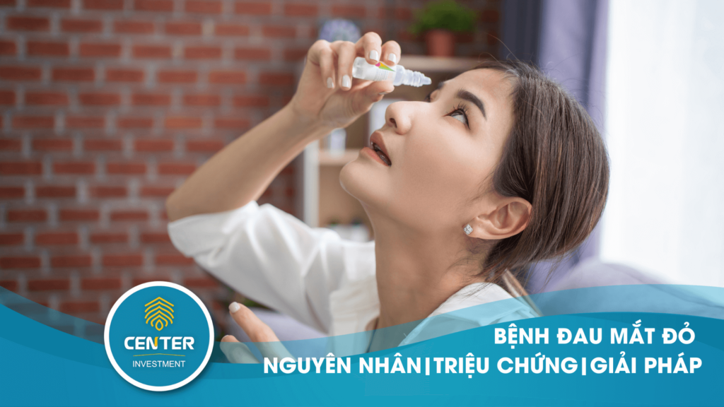 bệnh đau mắt đỏ